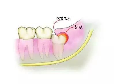 《智齿》港片资源_港片智齿下载_智齿港剧